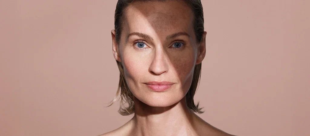 Cómo Eliminar Manchas en la Cara: Tratamientos Mesoestetic Profesionales 2025 - mesoesbeauty